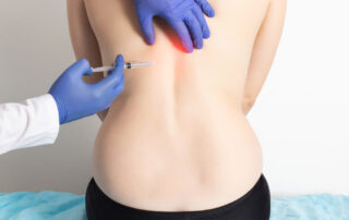 Pain Management Injections
