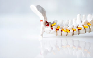 artificial cervical disc
